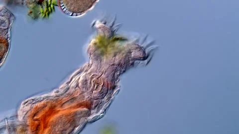 Rotifer (DIC microscope 400x magnification) 库存影片 310309897