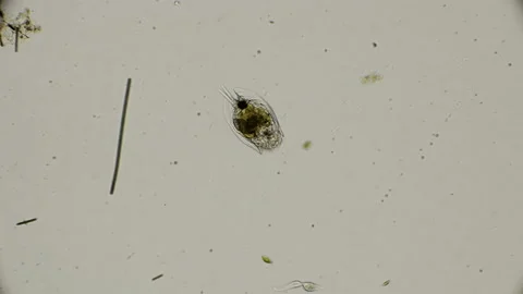 Rotifer Epiphanes senta under a microscope Stock Footage 93175816