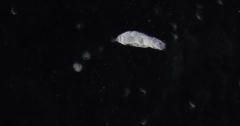 Rotifer explores aquatic microenvironment under dark field microscopy revealing Stock Footage 311585224