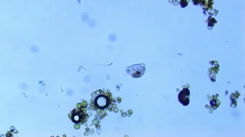 Rotifer feeding on green algae-100x Stock Footage 302709009