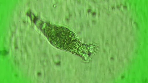 Rotifer Stock Footage 71176153