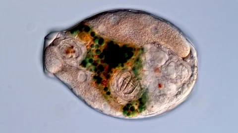 Rotifer 스톡 동영상 310647138