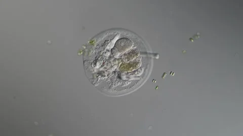 Rotifer foraging in the stream 200x 库存影片 339088037