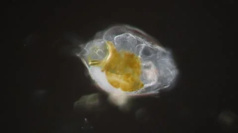 Rotifer foraging in the stream 200x Stock Footage 339487187