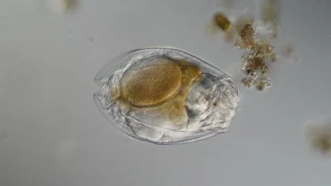 Rotifer foraging in the stream 200x 库存影片 340405422