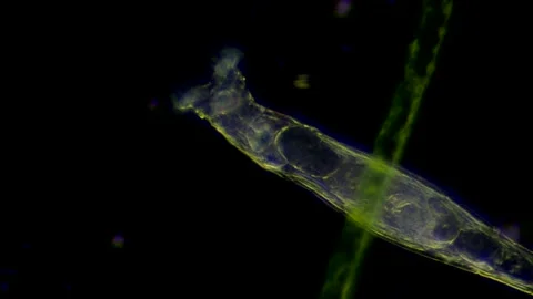 Rotifer of the genus Rotaria Vidéo 156509348