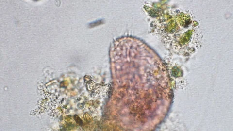 Rotifer magnification at optical microscope Video stock 102116704