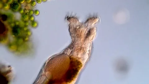 Rotifer microorganism under microscopy view 库存影片 310646072