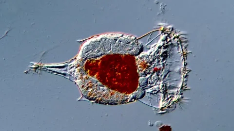 Rotifer microorganism under microscopy view 库存影片 317004957