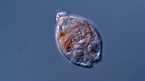 Rotifer (microscope 400x) 库存影片 310313266