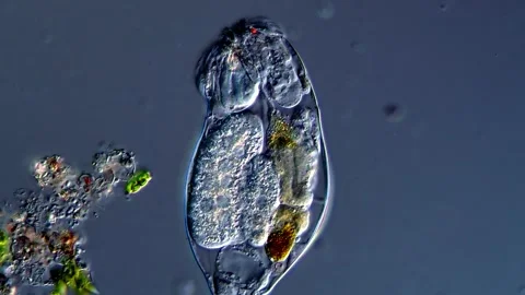 Rotifer (Microscope 400x) 库存影片 310648238