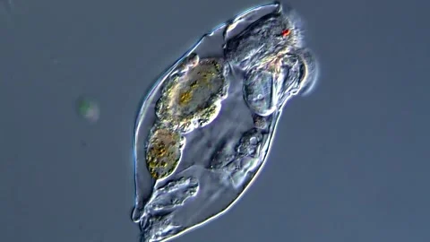 Rotifer (microscopy view 400x) 库存影片 310648836