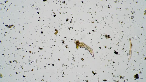 The rotifer moves in fresh water under a... | Stock Video | Pond5