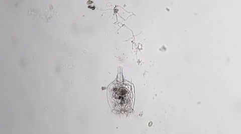 Rotifer or rotifera moves Stock Footage 65022304