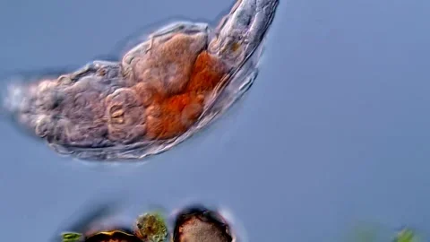 Rotifer (Phylum Rotifera, 400x) 스톡 동영상 310309294