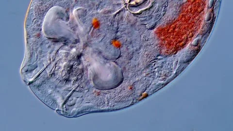 Rotifer (Phylum Rotifera, DIC microscopy 400x) 库存影片 310312655