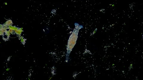 Rotifer Rotaria, LM 스톡 동영상 156510368
