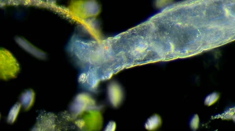 Rotifer (Rotaria sp.) Vidéo 64826978