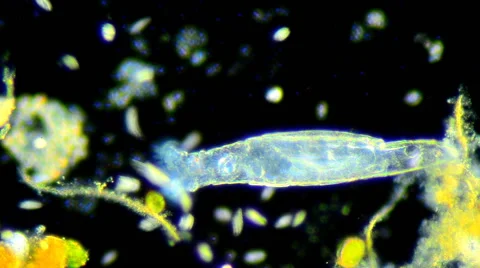 Rotifer (Rotaria sp.) Vidéo 64826981