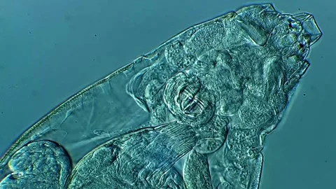 Rotifer in rotifera under microscope 400x Vídeos de archivo 306578290