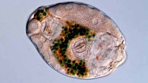 Rotifer (Rotifera under microscopy view) Vídeos de archivo 310646839