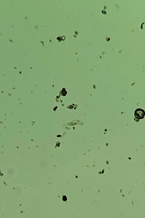 Rotifer sp. at 10x Under Brightfield Microscopy Stock Footage 335474871