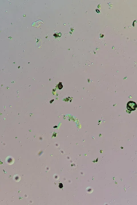 Rotifer sp. at 10x Under Polarized Light Microscopy Stock Footage 335474855