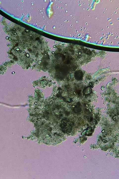 Rotifer sp. at 10x Under Polarized Light Microscopy Stock Footage 335474955