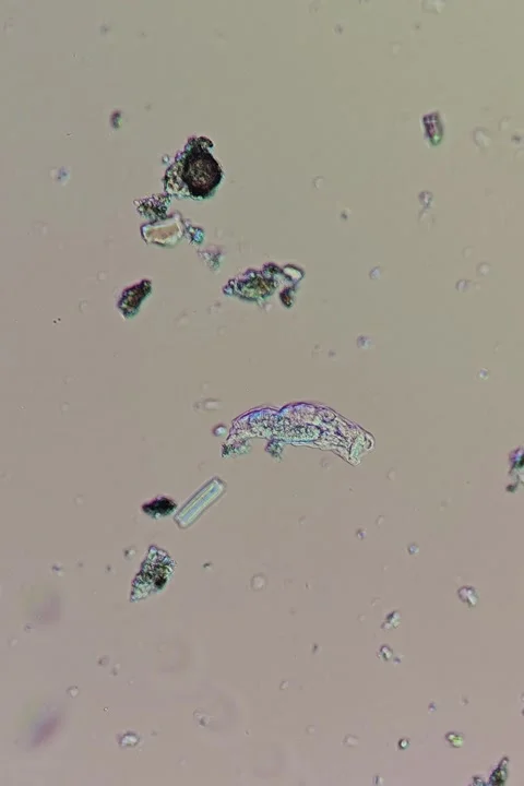 Rotifer sp. under polarized light microscopy at 10x magnification Video stock 333495698