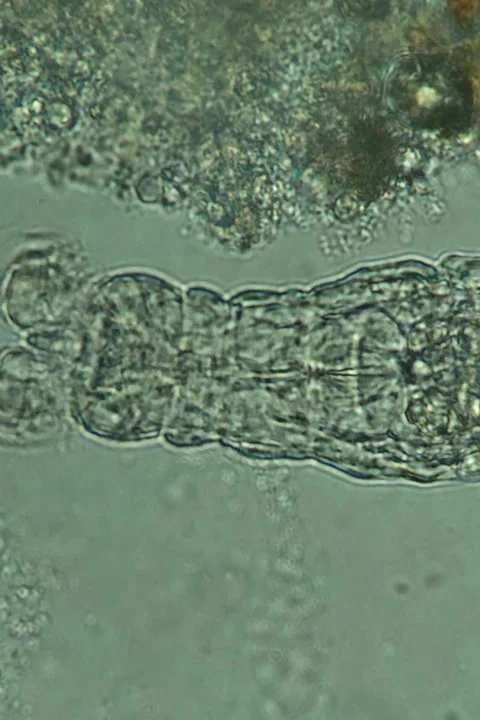 Rotifer Specimen at 100x Under Brightfield Microscopy Stock Footage 335475047