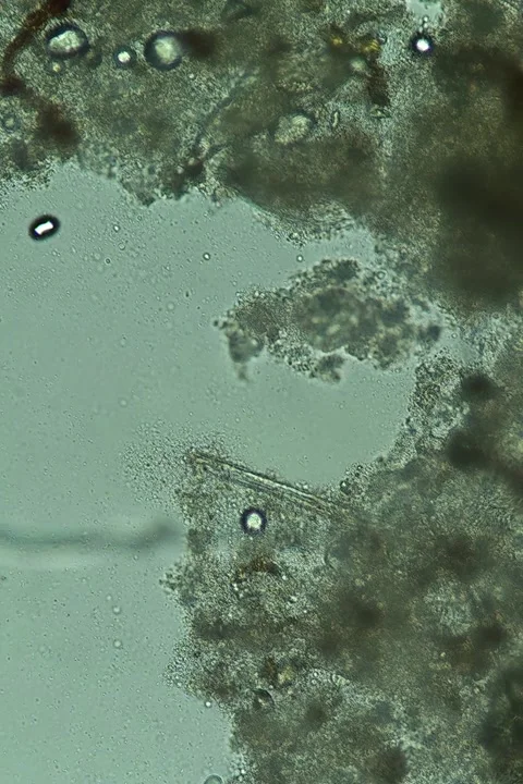 Rotifer Specimen at 20x Under Brightfield Microscopy Stock Footage 335474956