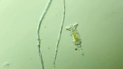 A rotifer under the microscope 100x magnification Stock Footage 313143398