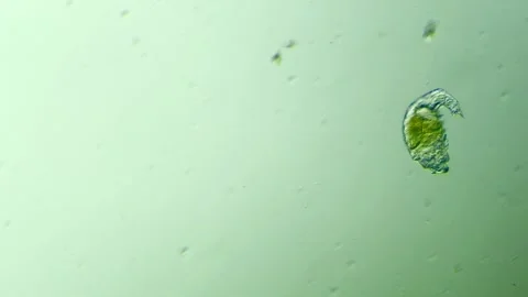 A rotifer under the microscope 100x magnification Stock Footage 313143408
