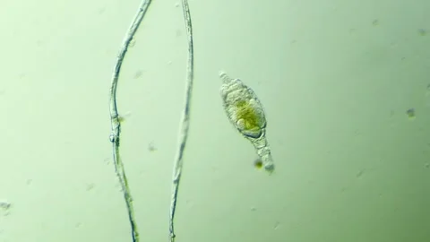 A rotifer under the microscope 100x magnification Stock Footage 313143457