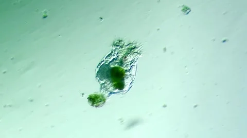 A rotifer under the microscope 100x magnification Stock Footage 313143521