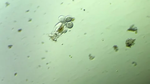 Rotifer under the microscope 100x magnification Stock Footage 313143827