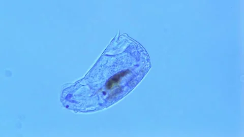 Rotifer under microscope-400X Stock Footage 302709024
