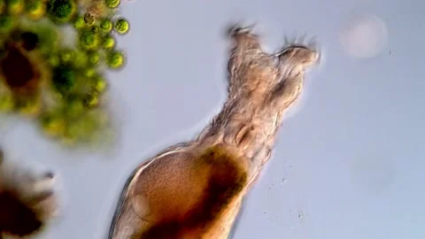 Rotifer under the microscope (400x) Vídeos de archivo 310646085