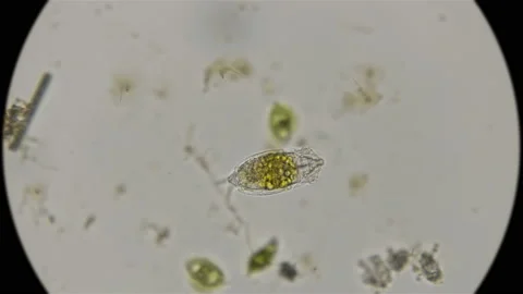 Rotifer under a microscope Stock Footage 93257126