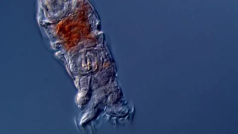 Rotifer under microscope 스톡 동영상 310313478