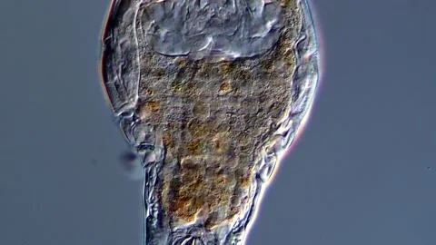 Rotifer under the microscope 库存影片 310648309