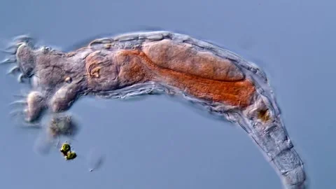 Rotifer under microscope microbiology Vídeos de archivo 310309375
