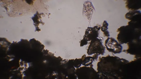 rotifer under the microscope, pond, roti... | Stock Video | Pond5