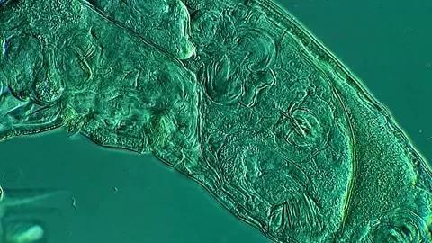 Rotifer under microscope view 400x magnification 库存影片 306578880