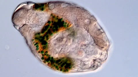 Rotifer under microscope view 400x 库存影片 310646855