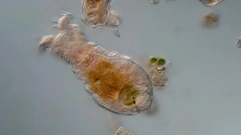 Rotifer under microscope view 스톡 동영상 306576259