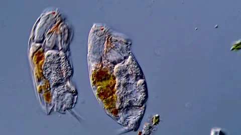 Rotifer under microscopic 库存影片 310647723