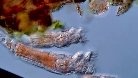 Rotifer under microscopy view 400x magnification 库存影片 310311375