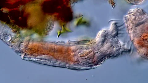 Rotifer under microscopy view 400x magnification 库存影片 310311396