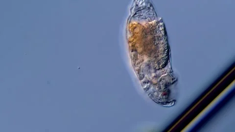Rotifer under microscopy view 400x magnification 库存影片 310312385